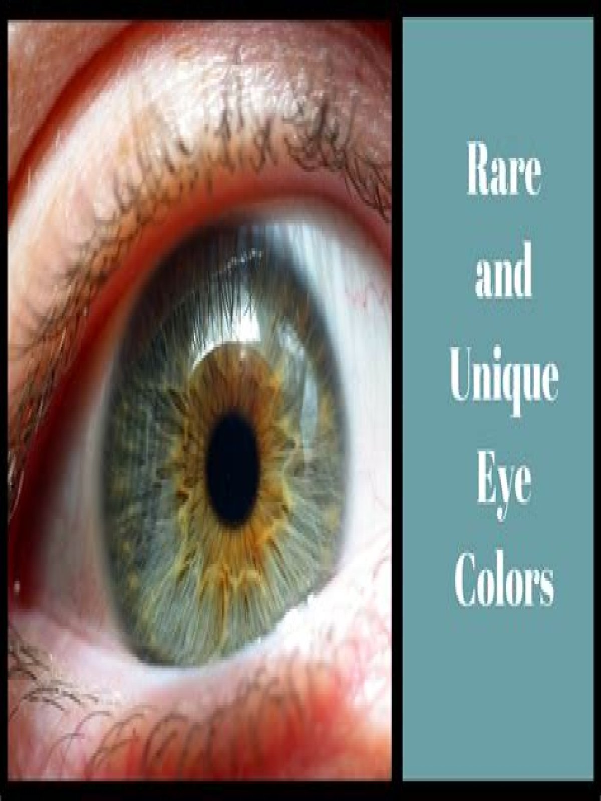 Are grey or blue eyes rarer?