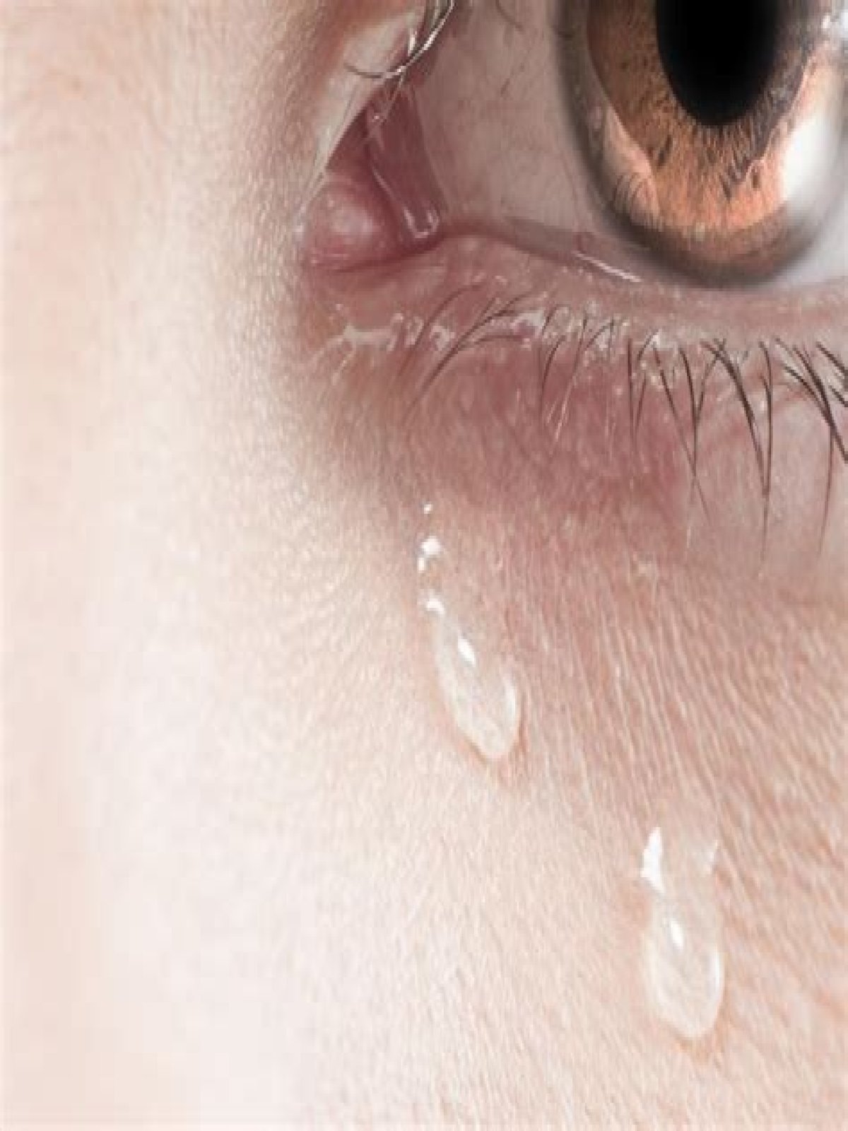 Is crying easily a disorder?