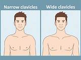 Can You Change Narrow Clavicles? Fact-Checking Workouts vs Clavicle Reduction and Widening Surgery