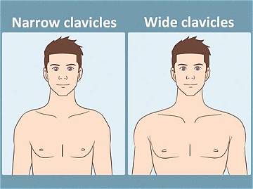 Can You Change Narrow Clavicles? Fact-Checking Workouts vs Clavicle Reduction and Widening Surgery