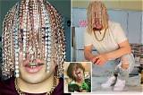 Dan Sur’s Gold Scalp Explained: Costs, Surgeon Warnings, and Viral Stunts
