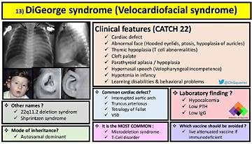 Visible Traits Vs. Reality: Identifying Digeorge Syndrome Markers in Public Figures